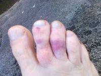 Don't put bike down on toe